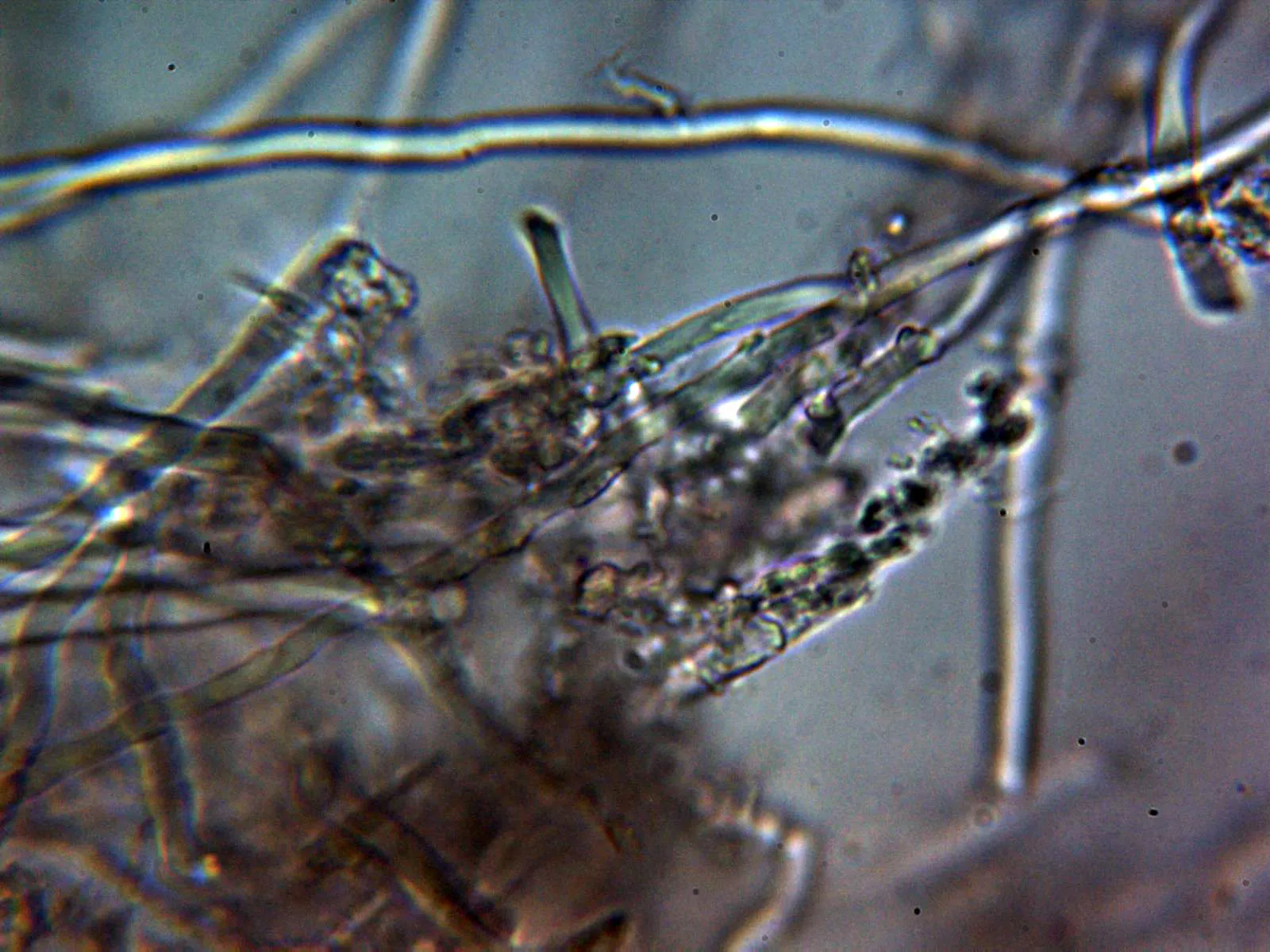 Microscopía de Skeletocutis percandida - 10 - Hifas agua 1